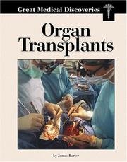 Cover of: Organ transplants by James Barter, James Barter