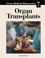 Cover of: Organ transplants