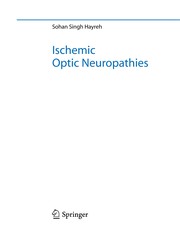 Cover of: Ischemic optic neuropathies | Sohan Singh Hayreh