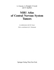 Cover of: MRI Atlas of Central Nervous System Tumors | Lucia Cecconi