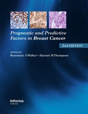 Cover of: Prognostic and predictive factors in breast cancer | Rosemary A. Walker