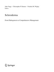 Cover of: Scleroderma: from pathogenesis to comprehensive management