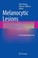 Cover of: Melanocytic Lesions