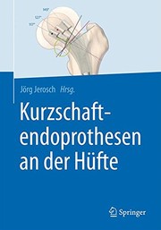Cover of: Kurzschaftendoprothesen an der Hüfte by Jörg Jerosch
