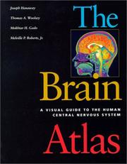 The brain atlas by Joseph Hanaway, Thomas A. Woolsey, Melville P. Roberts, Mokhta H. Gado