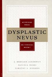Cover of: Dysplastic Nevus: A Typical Mole or Typical Myth