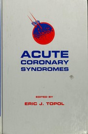 Cover of: Acute coronary syndromes by Eric J. Topol