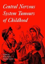 Cover of: Central Nervous System Tumours of Childhood (Clinics in Developmental Medicine (Mac Keith Press)) | Edward Estlin