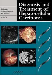 Diagnosis and treatment of hepatocellular carcinoma by Luigi Buscarini