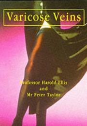 Cover of: Varicose Veins 3E