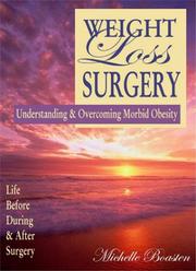 Cover of: Weight Loss Surgery  | Michelle Boasten