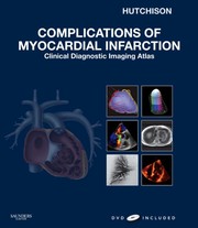Cover of: Complications of myocardial infarction by Stuart J. Hutchison