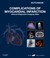 Cover of: Complications of myocardial infarction