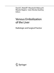 Venous embolization of the liver