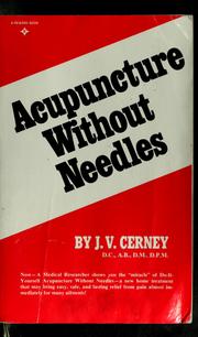 Cover of: Acupuncture without needles