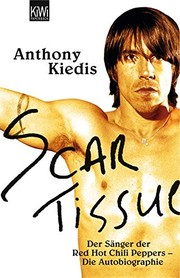 best books about bands Scar Tissue