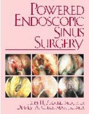 Cover of: Powered endoscopic sinus surgery by John H. Krouse, Dewey A. Christmas